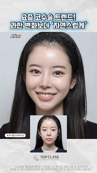 Thinking about jaw contouring?